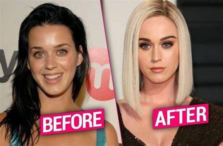 Has Katy Perry Gotten Plastic Surgery?
