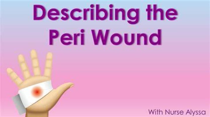 What Is Peri-wound? (Question)